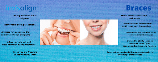 Ponciano Dental - Invisalign in Midtown Toronto