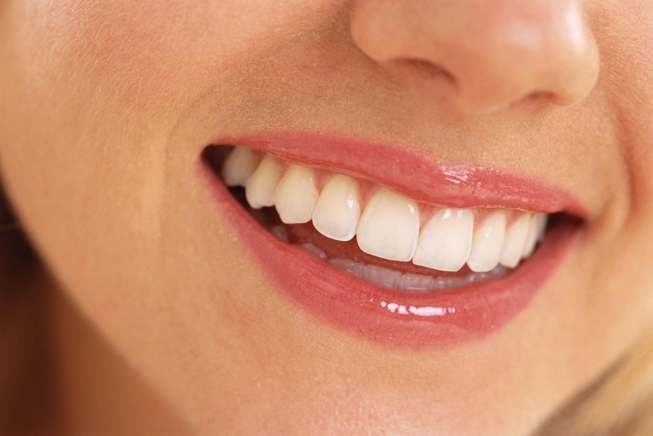 Cosemtic Dentistry - Ponciano Dental