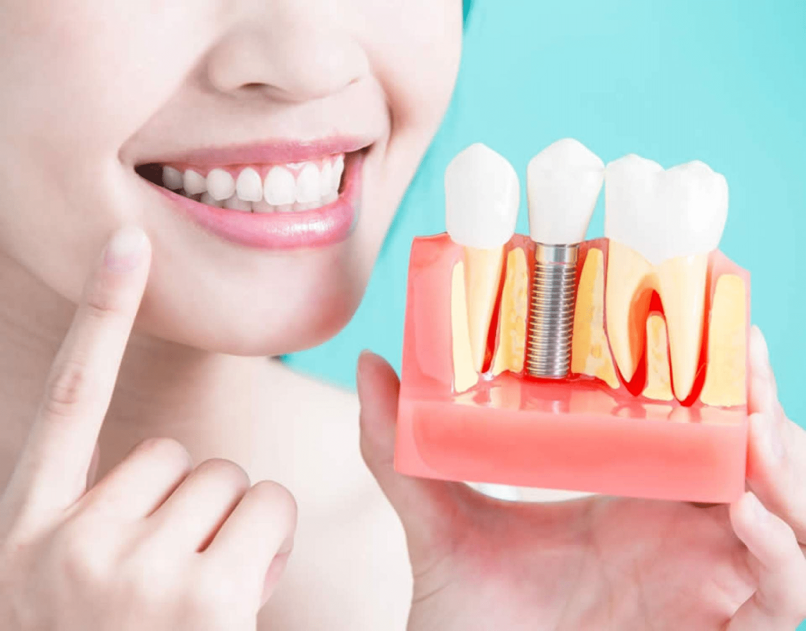 Ponciano Dental - Dental Implants in Midtown Toronto